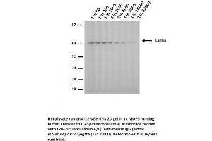 Image no. 1 for anti-Lamin A/C (LMNA) (Arg453Trp-Mutant) antibody (ABIN1042618) (Lamin A/C Antikörper  (Arg453Trp-Mutant))