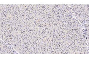 Detection of ANGPT1 in Human Liver Tissue using Polyclonal Antibody to Angiopoietin 1 (ANGPT1) (Angiopoietin 1 Antikörper  (AA 284-452))