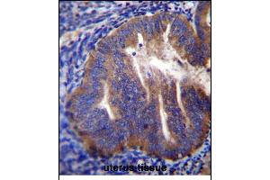 KLC2 Antibody (N-term) (ABIN656175 and ABIN2845505) immunohistochemistry analysis in formalin fixed and paraffin embedded human uterus tissue followed by peroxidase conjugation of the secondary antibody and DAB staining.