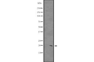 Western blot analysis of CIRBP expression in HCT116 whole cell lysate ,The lane on the left is treated with the antigen-specific peptide. (CIRBP Antikörper  (C-Term))
