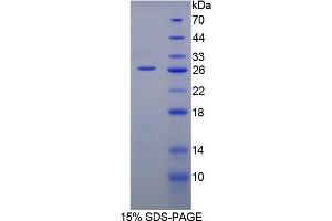 Image no. 1 for Interleukin 12 alpha (IL12A) (AA 23-215) protein (His tag) (ABIN6236553) (IL12A Protein (AA 23-215) (His tag))