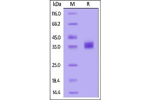 SARS-CoV-2 Spike RBD, His Tag (BA. (SARS-CoV-2 Spike Protein (BA.2 - Omicron) (His tag))