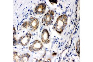 IHC analysis of FAK/PTK2 using anti-FAK/PTK2 antibody (ABIN3043556).
