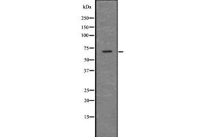 Western blot analysis of PINK1 using A549 whole  lysates. (PINK1 Antikörper)