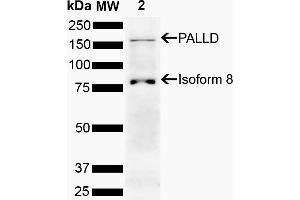 Western blot analysis of Human Cervical cancer cell line (HeLa) lysate showing detection of 150.