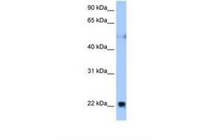 Image no. 1 for anti-Reticulon 4 (RTN4) (AA 81-130) antibody (ABIN6738273) (Reticulon 4 Antikörper  (AA 81-130))