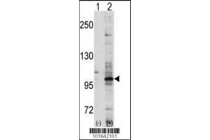 Western blot analysis of EPHA7 using EphA7 Antibody using 293 cell lysates (2 ug/lane) either nontransfected (Lane 1) or transiently transfected with the EPHA7 gene (Lane 2). (EPH Receptor A7 Antikörper  (C-Term))