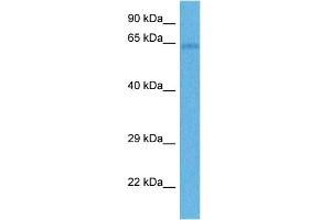 Host:  Rabbit  Target Name:  FZD4  Sample Tissue:  Human Lung Tumor  Antibody Dilution:  1ug/ml (FZD4 Antikörper  (Middle Region))