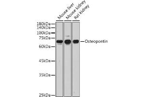 Western blot analysis of extracts of various cell lines, using Osteopontin antibody (ABIN3021921, ABIN3021922, ABIN3021923 and ABIN6217674) at 1:1000 dilution. (Osteopontin Antikörper  (AA 17-314))