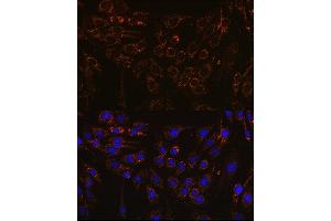 Immunofluorescence analysis of C6 cells using IFN Rabbit pAb (ABIN7267947) at dilution of 1:100 (40x lens). (IFNAR1 Antikörper  (AA 470-557))