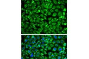 Immunofluorescence analysis of A-549 cells using SAT2 Polyclonal Antibody (SAT2 Antikörper)
