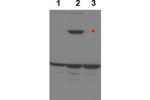 Image no. 1 for anti-Protein Phosphatase 1, Regulatory Subunit 13B (PPP1R13B) (Internal Region) antibody (ABIN401394) (PPP1R13B Antikörper  (Internal Region))