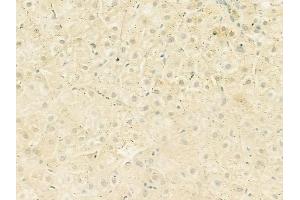 ABIN6259716 and ABIN6273088 at 1/100 staining human normal liver tissue by IHC-P. (ACADVL Antikörper  (Internal Region))