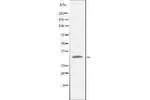 Western blot analysis of extracts from HUVEC cells treated with PMA using TNAP1 antibody. (TNFAIP1 Antikörper  (Internal Region))