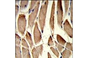 Formalin-fixed and paraffin-embedded human skeletal muscle reacted with RRM2 Antibody (Center), which was peroxidase-conjugated to the secondary antibody, followed by DAB staining. (RRM2 Antikörper  (AA 96-125))