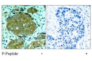 Image no. 1 for anti-Nuclear Factor of kappa Light Polypeptide Gene Enhancer in B-Cells 1 (NFKB1) (pSer932) antibody (ABIN197008) (NFKB1 Antikörper  (pSer932))