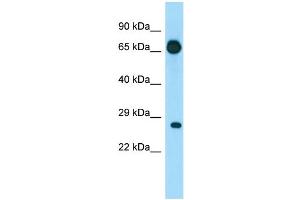 WB Suggested Anti-EIF4E1B Antibody Titration: 1.