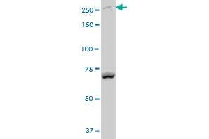 BCOR polyclonal antibody (A01), Lot # 051214JC01 Western Blot analysis of BCOR expression in Y-79 (ABIN1339626). (BCOR Antikörper  (AA 1361-1460))