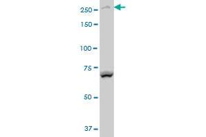 BCOR polyclonal antibody (A01), Lot # 051214JC01 Western Blot analysis of BCOR expression in Y-79 (ABIN1339626).