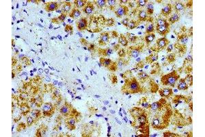 Immunohistochemistry of paraffin-embedded human liver tissue using ABIN7168945 at dilution of 1:100 (AGXT Antikörper  (AA 112-294))