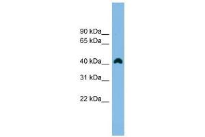 ANKRD42 antibody used at 1 ug/ml to detect target protein. (ANKRD42 Antikörper  (N-Term))