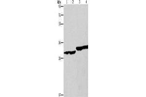 Western Blotting (WB) image for anti-2,4-Dienoyl CoA Reductase 1, Mitochondrial (DECR1) antibody (ABIN2434542) (DECR1 Antikörper)