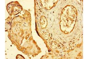 Immunohistochemistry of paraffin-embedded human placenta tissue using ABIN7151194 at dilution of 1:100 (RNF4 Antikörper  (AA 1-103))