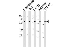 All lanes : Anti-H Antibody (Center) at 1:1000-1:2000 dilution Lane 1: Human cerebellum lysate Lane 2: Hela whole cell lysate Lane 3: HepG2 whole cell lysate Lane 4: SH-SY5Y whole cell lysate Lane 5: U-87 MG whole cell lysate Lysates/proteins at 20 μg per lane. (AMH Antikörper  (AA 424-451))