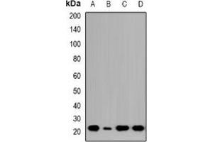 Western blot analysis of NTPCR expression in HCT116 (A), Jurkat (B), COLO205 (C), LO2 (D) whole cell lysates. (C1orf57 Antikörper  (C-Term))