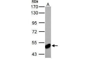 WB Image ABAT antibody detects ABAT protein by Western blot analysis. (ABAT Antikörper)