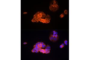 Immunofluorescence analysis of MCF7 cells using MMP13 Rabbit mAb (ABIN7268419) at dilution of 1:100 (40x lens). (MMP13 Antikörper)