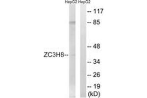 Western blot analysis of extracts from HepG2 cells, using ZC3H8 Antibody. (ZC3H8 Antikörper  (AA 81-130))