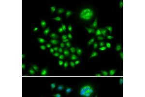 Immunofluorescence analysis of HeLa cells using AGFG1 Polyclonal Antibody (AGFG1 Antikörper)
