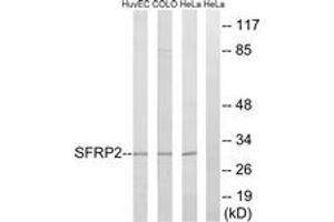 Western blot analysis of extracts from HeLa/COLO/HuvEc cells, using SFRP2 Antibody. (SFRP2 Antikörper  (AA 119-168))