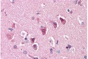 Immunohistochemistry (Formalin-fixed Paraffin-embedded Sections) (IHC (fp)) image for anti-Solute Carrier Family 29 (Nucleoside Transporters), Member 1 (SLC29A1) (C-Term) antibody (ABIN768671)