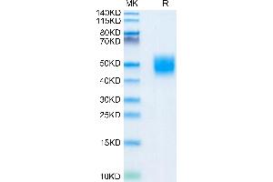 CD200 Protein (CD200) (AA 31-232) (His tag)