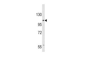 Western blot analysis of CACNA2D3 Antibody (C-term) (ABIN653695 and ABIN2843014) in HepG2 cell line lysates (35 μg/lane). (CACNA2D3 Antikörper  (C-Term))