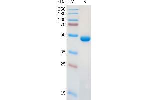 Human LG Protein, hFc Tag on SDS-PAGE under reducing condition.