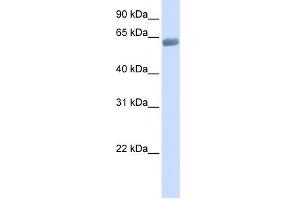 WB Suggested Anti-SLC47A2 Antibody Titration: 0. (SLC47A2 Antikörper  (C-Term))