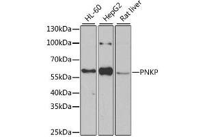 Western blot analysis of extracts of various cell lines, using PNKP antibody. (PNKP Antikörper  (AA 60-320))