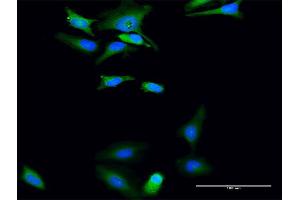 Immunofluorescence (IF) image for anti-UDP-Glucose Pyrophosphorylase 2 (UGP2) (AA 1-508) antibody (ABIN948611)