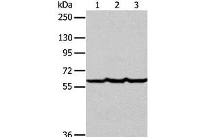 Western Blot analysis of Human liver cancer tissue, hela and Jurkat cell using Factor IX Polyclonal Antibody at dilution of 1:400 (Coagulation Factor IX Antikörper)