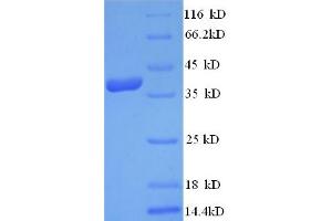 SDS-PAGE (SDS) image for Thymocyte Alloantigen (TTHY) (AA 23-147), (partial) protein (His-SUMO Tag) (ABIN5710560)