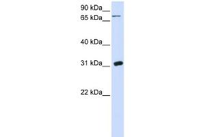 WB Suggested Anti-UPP1 Antibody Titration:  0.