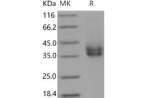 Western Blotting (WB) image for Fc Fragment of IgA, Receptor For (FCAR) protein (His tag) (ABIN7321241)