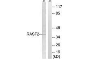 Western blot analysis of extracts from Jurkat cells, using RASSF2 Antibody.