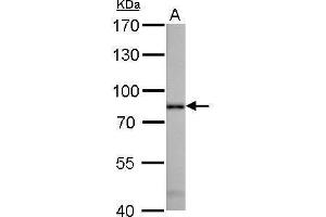 Radixin Antikörper