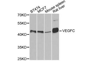 Western blot analysis of extracts of various cell lines, using VEGFC antibody (ABIN5971381) at 1/500 dilution. (VEGFC Antikörper)