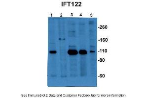 Sample Type: 1. (IFT122 Antikörper  (C-Term))