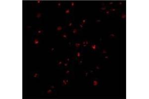 Immunofluorescence of IRE1p in A20 cells with AP30444PU-N IRE1p antibody at 2 ug/ml. (ERN1 Antikörper  (C-Term))